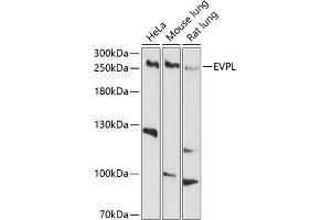 Western blot analysis of extracts of various cell lines, using EVPL antibody (ABIN6129811, ABIN6140350, ABIN6140351 and ABIN6214378) at 1:1000 dilution. (Envoplakin Antikörper  (AA 1784-2033))