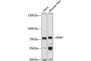 Western blot analysis of extracts of various cell lines, using RMI1 Antibody (ABIN1682540, ABIN3019316, ABIN3019317, ABIN5664937 and ABIN6220821) at 1:1000 dilution. (RMI1 Antikörper  (AA 1-350))