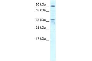 Western Blotting (WB) image for anti-Zinc Finger CCCH-Type Containing 7B (ZC3H7B) antibody (ABIN2460487)