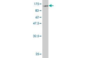 Western Blot detection against Immunogen (88. (ZYX Antikörper  (AA 1-572))