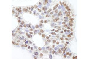 Immunohistochemistry (IHC) image for anti-Ubiquitin Specific Peptidase 47 (USP47) (C-Term) antibody (ABIN7449031)