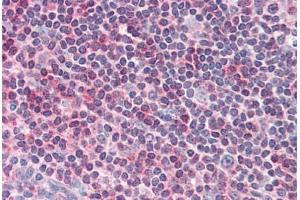 Human Tonsil (formalin-fixed, paraffin-embedded) stained with CENTB1 antibody ABIN337010 at 5 ug/ml followed by biotinylated anti-goat IgG secondary antibody ABIN481715, alkaline phosphatase-streptavidin and chromogen. (ACAP1 Antikörper  (AA 728-740))