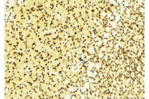 Immunohistochemistry (IHC) image for anti-Sirtuin 1 (SIRT1) (C-Term) antibody (ABIN6254894)