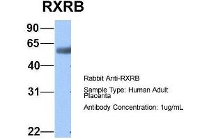 Host:  Rabbit  Target Name:  RXRB  Sample Type:  Human Adult Placenta  Antibody Dilution:  1.