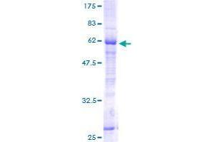Image no. 1 for Chromosome 12 Open Reading Frame 24 (C12orf24) (AA 1-273) protein (GST tag) (ABIN1347088)