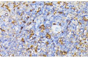 Immunohistochemistry of paraffin-embedded Rat spleen using VEGF Receptor 1 Polyclonal Antibody at dilution of 1:100 (40x lens). (FLT1 Antikörper)