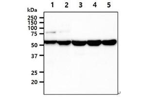The cell lysates (40ug) were resolved by SDS-PAGE, transferred to PVDF membrane and probed with anti-human UGDH antibody (1:1000). (UGDH Antikörper)