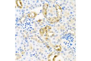Immunohistochemistry of paraffin-embedded mouse kidney using CST4 antibody at dilution of 1:100 (40x lens). (CST4 Antikörper)