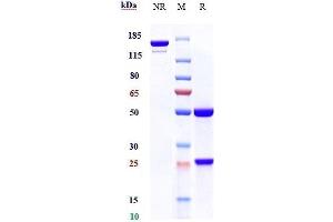Anti-AXL / UFO Reference Antibody (tilvestamab) on SDS-PAGE under reducing (R) condition. (Rekombinanter AXL (Tilvestamab Biosimilar) Antikörper)