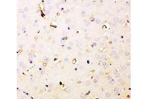 IHC-P staining of rat brain tissue (Dihydrofolate Reductase Antikörper  (AA 2-187))