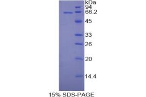 SDS-PAGE analysis of Rat MAP2 Protein.