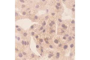 Immunohistochemistry (IHC) image for anti-Chemokine (C-X-C Motif) Ligand 10 (CXCL10) antibody (ABIN1854144) (CXCL10 Antikörper)