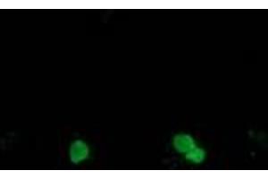 Image no. 1 for anti-Synovial Sarcoma, X Breakpoint 1 (SSX1) antibody (ABIN1501158) (SSX1 Antikörper)