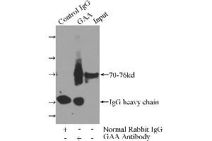 IP analysis of mouse liver tissue lysate (4000 μg), using GAA antibody (4 μg, 1/600 dilution). (GAA Antikörper)