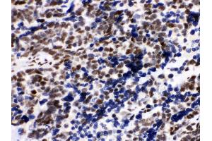Immunohistochemistry (IHC) image for anti-X-Ray Repair Complementing Defective Repair in Chinese Hamster Cells 5 (Double-Strand-Break Rejoining) (XRCC5) (AA 649-676), (C-Term) antibody (ABIN3043964)