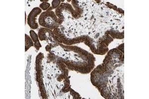Immunohistochemical staining of human placenta with YIPF2 polyclonal antibody  shows strong cytoplasmic positivity in trophoblastic at 1:50-1:200 dilution. (YIPF2 Antikörper)