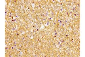 Immunohistochemistry of paraffin-embedded human brain tissue using ABIN7152234 at dilution of 1:100 (SLC1A2 Antikörper  (AA 460-574))