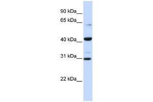 WB Suggested Anti-ZNF193 Antibody Titration:  0.