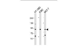 All lanes : Anti-TBK Antibody  at 1:2000 dilution Lane 1: HT-1080 whole cell lysate Lane 2: K562 whole cell lysate Lane 3: MCF-7 whole cell lysate Lysates/proteins at 20 μg per lane. (TBK1 Antikörper  (AA 150-181))