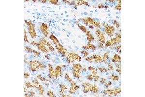 Immunohistochemistry of paraffin-embedded mouse pancreas using CTRL Rabbit mAb (ABIN7266395) at dilution of 1:100 (40x lens). (Chymotrypsin Antikörper)
