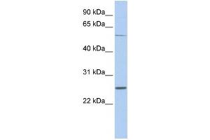 Western Blotting (WB) image for anti-Sodium Channel, Voltage-Gated, Type I, beta (SCN1B) antibody (ABIN2458126) (SCN1B Antikörper)