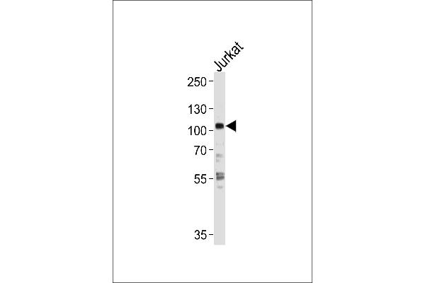 Hexokinase 2 Antikörper  (AA 453-483)