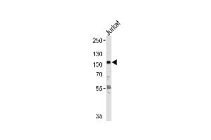 HK2 Antibody  f western blot analysis in Jurkat cell line lysates (35 μg/lane). (Hexokinase 2 Antikörper  (AA 453-483))