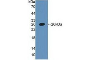 Detection of Recombinant PDPN, Human using Polyclonal Antibody to Podoplanin (PDPN) (Podoplanin Antikörper  (AA 23-143))