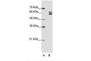 Image no. 1 for anti-Mismatch Repair Protein 2 (MSH2) (AA 151-200) antibody (ABIN203217) (MSH2 Antikörper  (AA 151-200))