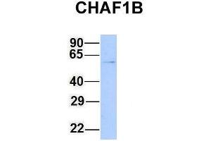 Western Blotting (WB) image for anti-Chromatin Assembly Factor 1, Subunit B (p60) (CHAF1B) (N-Term) antibody (ABIN2782376)