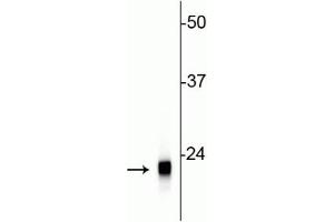 Western blot of rat cerebellar lysate showing specific immunolabeling of the ~22 kDa VSNL1 protein.