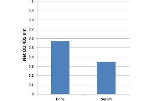 Taurine Detection in Human Urine or Serum. (Taurine Assay Kit)