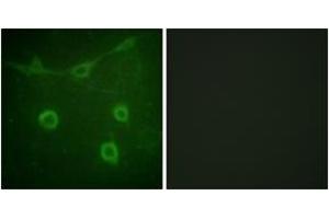 Immunofluorescence analysis of NIH-3T3 cells, using Trk A (Phospho-Tyr496) Antibody. (TRKA Antikörper  (pTyr496))