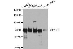 Western blot analysis of extracts of various cell lines, using IGF2BP3 antibody. (IGF2BP3 Antikörper  (AA 300-579))