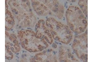 Detection of IkBb in Human Kidney Tissue using Polyclonal Antibody to Inhibitory Subunit Of NF Kappa B Beta (IkBb) (Inhibitory Subunit of NF kappa B beta (AA 85-332) Antikörper)