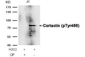 Western blot analysis of extracts from JK cells, treated with H2O2 or calf intestinal phosphatase (CIP), using Cortactin (Phospho-Tyr466) Antibody. (Cortactin Antikörper  (pTyr466))