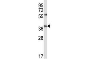 CD33 antibody western blot analysis in NCI-H460 lysate