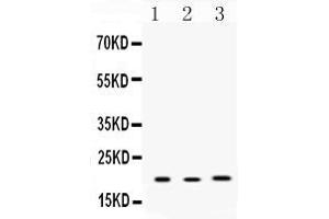 Western blot analysis of Anterior Gradient 2 expression in rat lung extract ( Lane 1), mouse liver extract ( Lane 2) and MCF-7 whole cell lysates ( Lane 3). (AGR2 Antikörper  (AA 21-175))