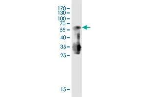 Western Blot detection against Immunogen (55. (HRASLS5 Antikörper  (AA 1-269))