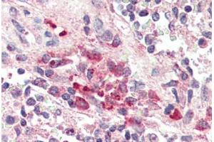 Human Spleen, Macrophages (formalin-fixed, paraffin-embedded) stained with TREM2 antibody ABIN337127 at 2. (TREM2 Antikörper  (AA 199-212))