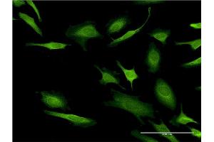 Immunofluorescence of monoclonal antibody to CASP10 on HeLa cell. (Caspase 10 Antikörper  (AA 19-187))