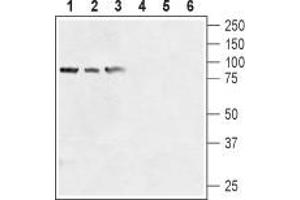 Western blot analysis of human prostate carcinoma cell lines (LNCaP (lanes 1 and 4), DU145 (lanes 2 and 5), PC-3 (lanes 3 and 6) lysates: - 1-3. (TRPV6 Antikörper  (1st Extracellular Loop))
