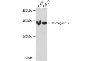 Western blot analysis of extracts of various cell lines, using Desmoglein 3 Rabbit mAb (ABIN7266741) at 1:1000 dilution. (Desmoglein 3 Antikörper)