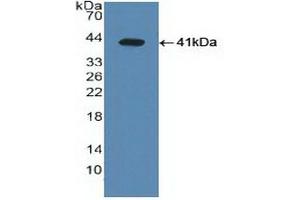 Western blot analysis of recombinant Human LXRa.
