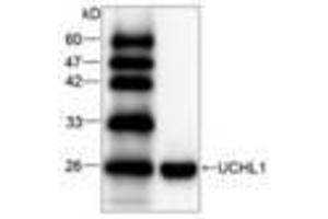 Image no. 1 for anti-Ubiquitin Carboxyl-terminal Esterase L1 (Ubiquitin Thiolesterase) (UCHL1) antibody (ABIN791511) (UCHL1 Antikörper)