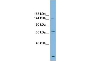 Western Blotting (WB) image for anti-ATP-Binding Cassette, Sub-Family B (MDR/TAP), Member 1 (ABCB1) (Middle Region) antibody (ABIN2773986)