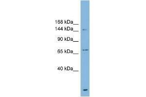 WB Suggested Anti-ABCB1 Antibody Titration:  0. (ABCB1 Antikörper  (Middle Region))