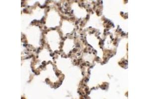 Immunohistochemical analysis of SPINK7 in rat lung tissue with SPINK7 polyclonal antibody  at 5 ug/mL. (SPINK7/ECRG2 Antikörper  (C-Term))