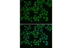 Immunofluorescence analysis of HeLa cells using BTK antibody (ABIN5970757). (BTK Antikörper)