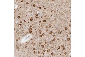 Immunohistochemical staining of human cerebral cortex with C9orf50 polyclonal antibody  shows strong cytoplasmic positivity in neurons. (C9ORF50 Antikörper)